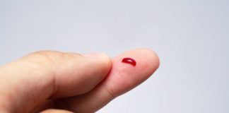 Altcoins Bleed Whenever Bitcoin Remains around $10 k Level