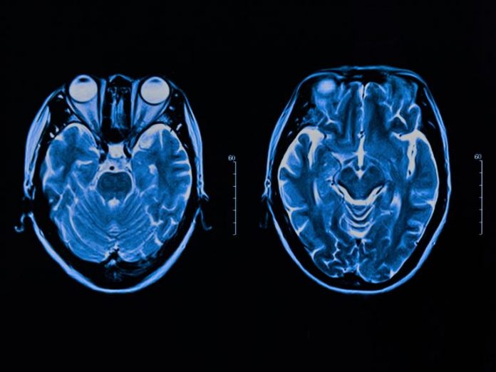 Microsoft wishes to '’re advertisement individuals'’s brain waves' ‘to mine cryptocurrency