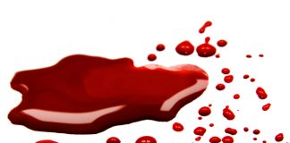 Bitcoin Carnage Continues As BTC Breaks Down To $34 K