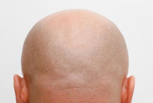 All Buzz? BALD Meme Coin’s Volume Shaved By 96% All Buzz? BALD Meme Coin’s Volume Shaved By 96%