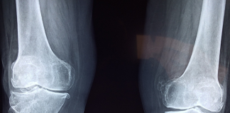 Shibarium Community Lull – How It Impacts The Future Of BONE