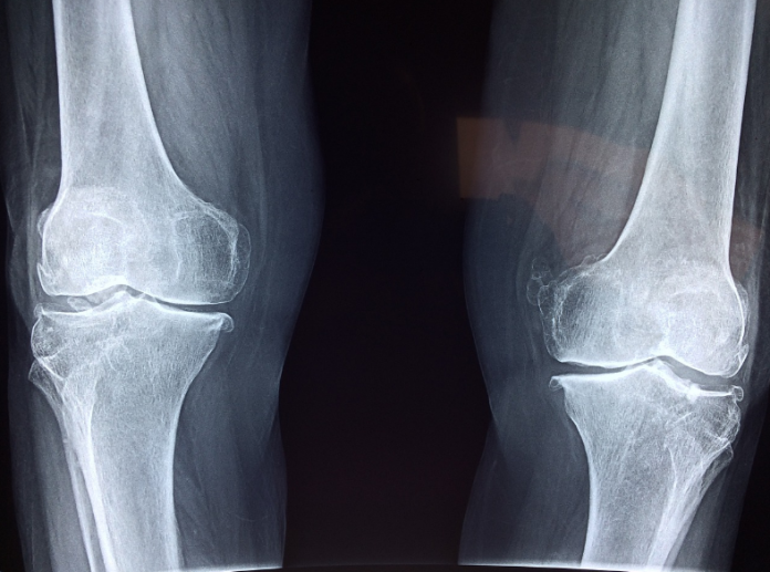 Shibarium Community Lull – How It Impacts The Future Of BONE